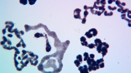 Microcystis sp.
