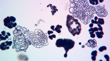 Dolichospermum sp. (curly, spring-like shapre) and Microcystis sp. (dark clumps)